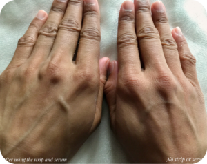 Side-by-side comparison 2: both hands